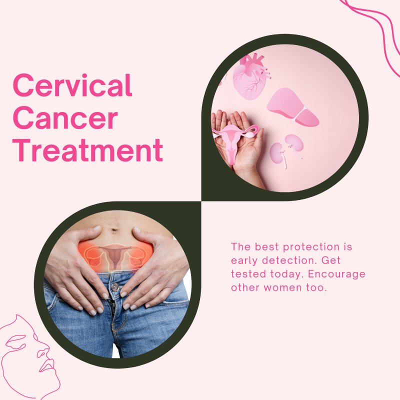 best-cervical-cancer-treatment
