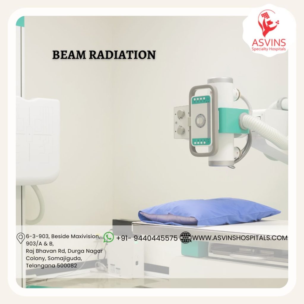 beam radiation