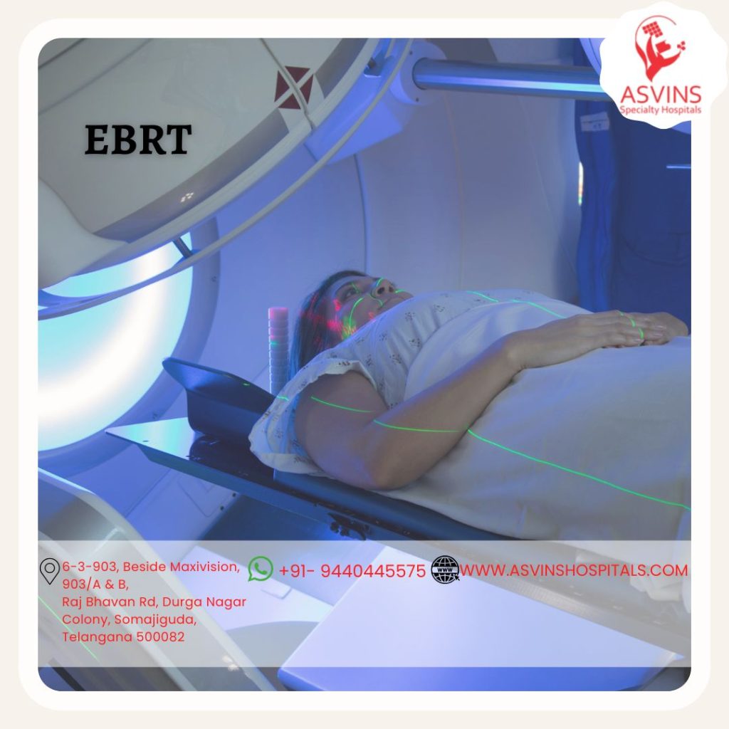 ebrt