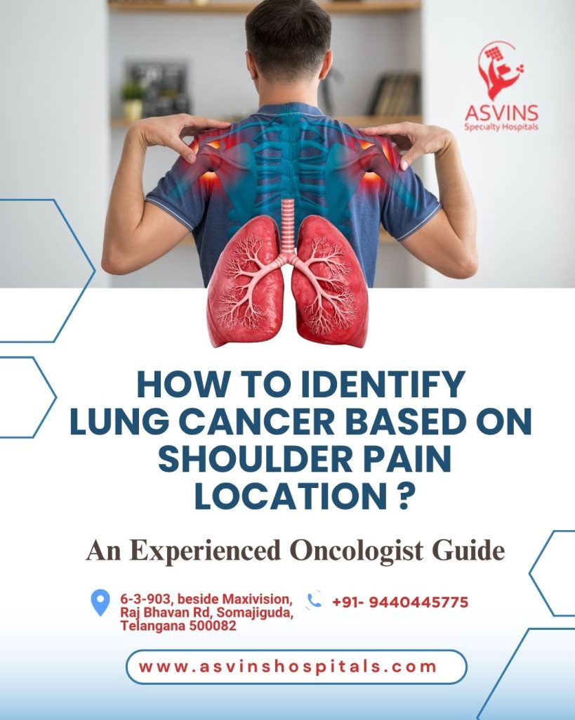 how to identify lung cancer based on shoulder pain location