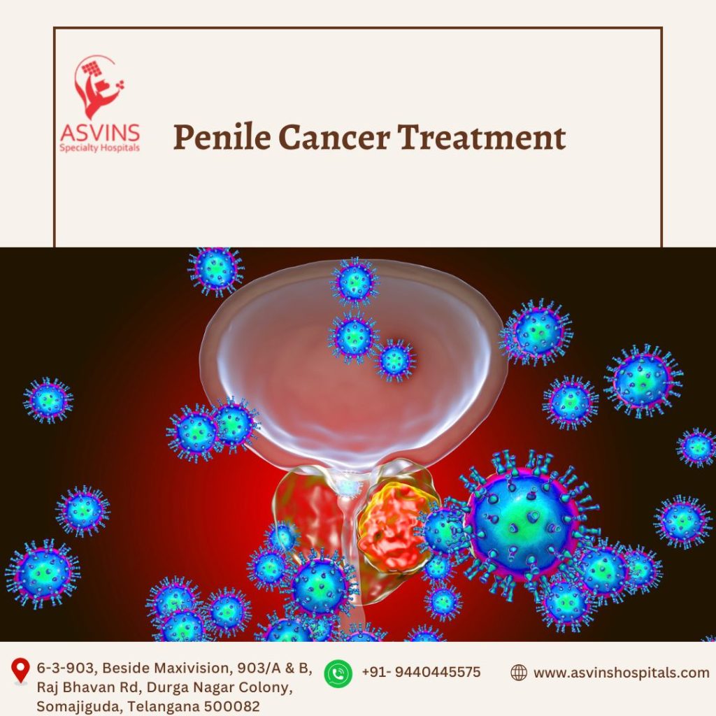 penile cancer treatment