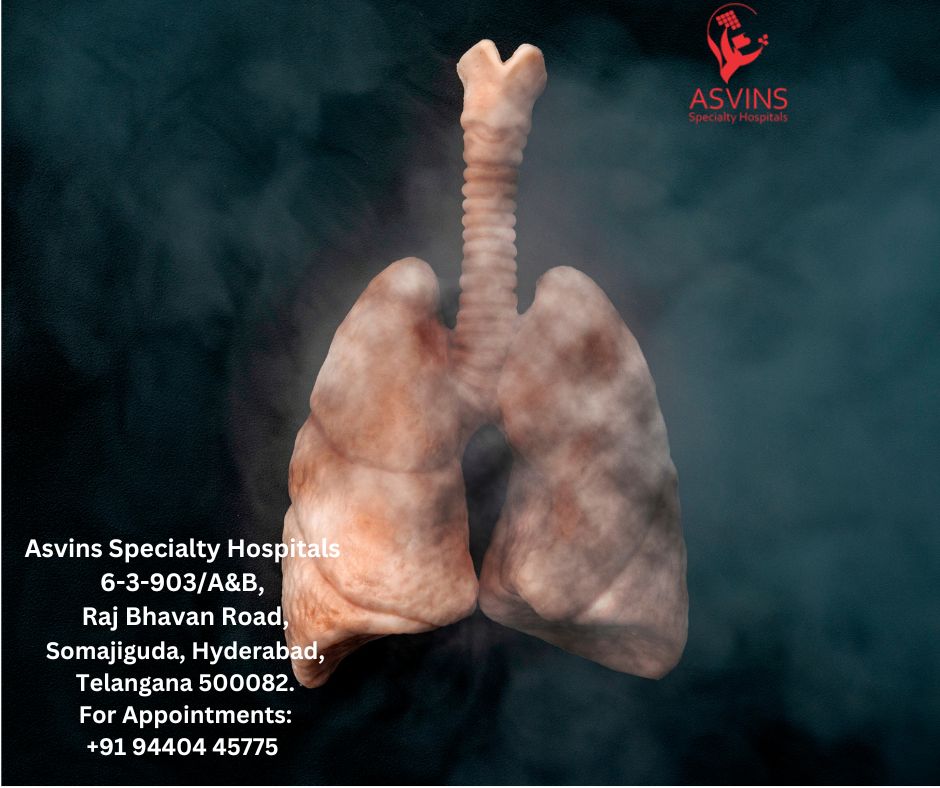 lung cancer causes