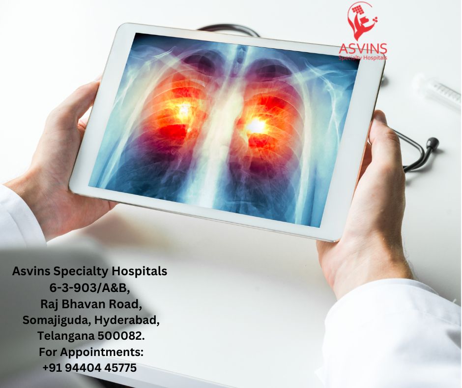 lung cancer diagnosis