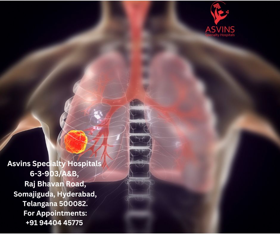 lung cancer icd 10