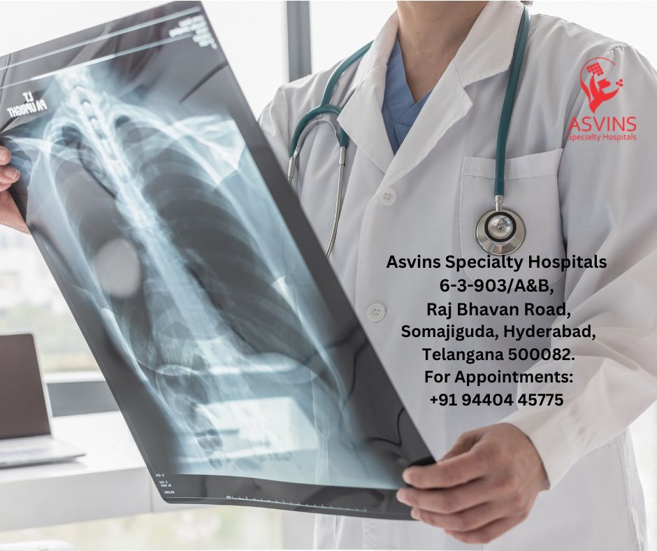 lung cancer xray