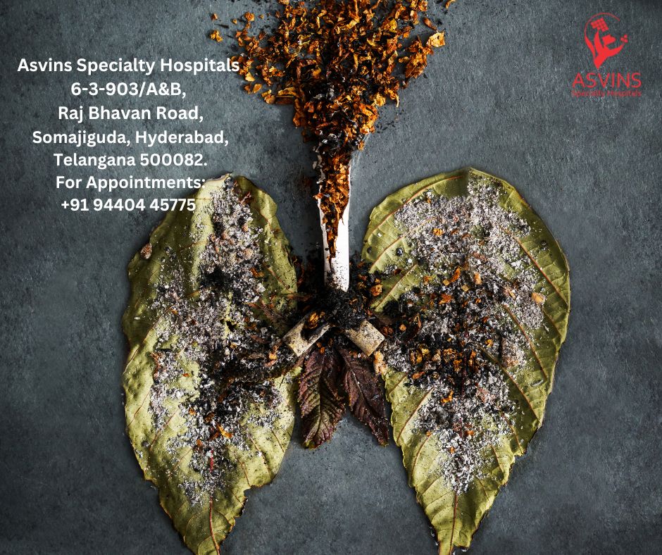 seminoma lung cancer