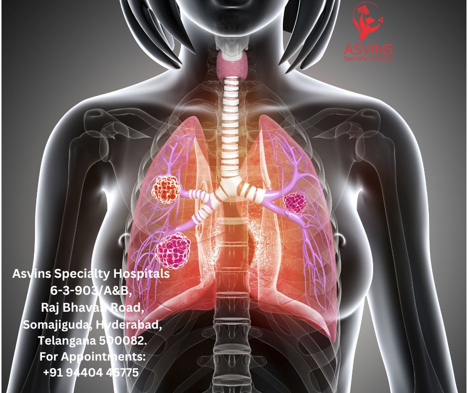 stage 4 lung cancer symptoms