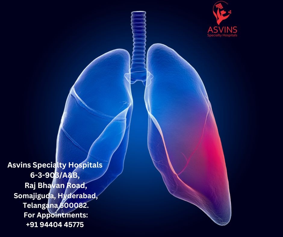 stage 4 lung cancer