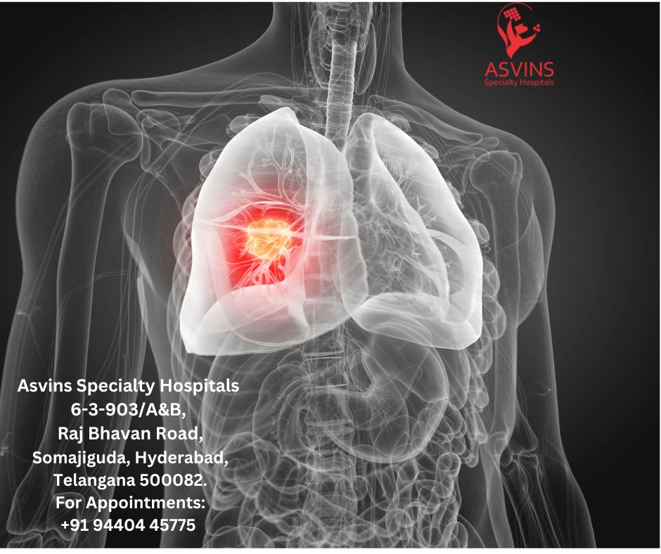 tnm staging lung cancer